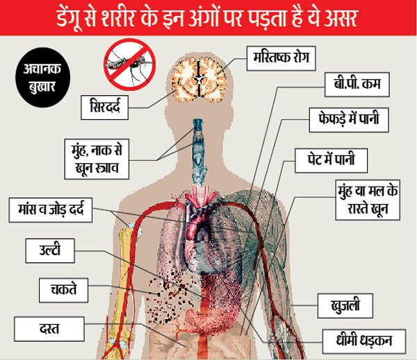 symptoms of dengu in children बच्चों में डेंगू के लक्षण